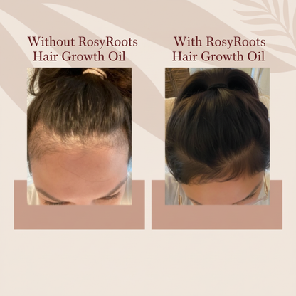 Without & With RosyRoots Hair Growth Oil